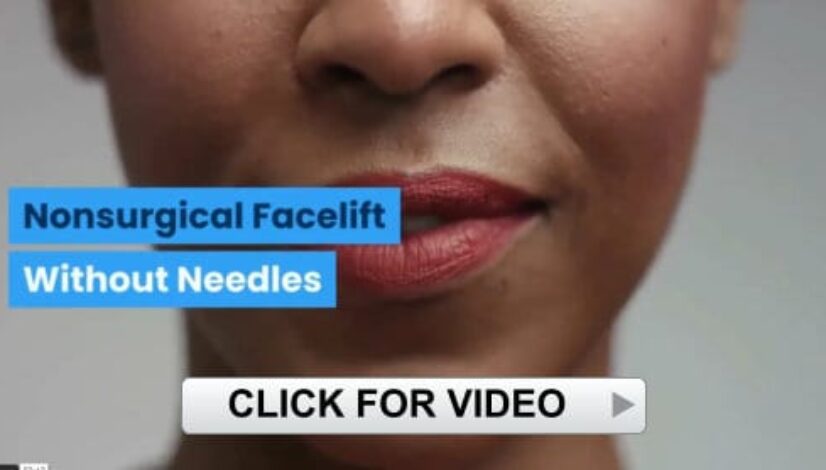 NonSurgicalFaceLift