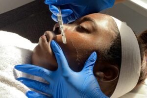 Dermaplaning_Moment